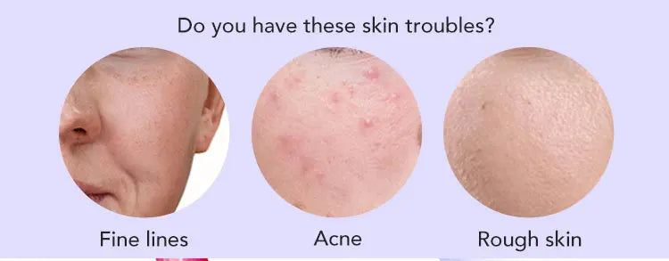 LKIAE Whitening Reduce Dark Spots & Hyperpigmentation Facial Brightening Vitamin C Bar Soap For The Skin Care