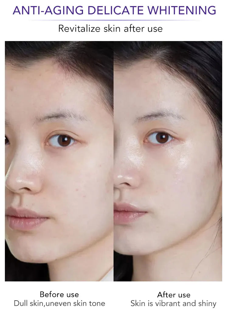 LKIAE Whitening Reduce Dark Spots & Hyperpigmentation Facial Brightening Vitamin C Bar Soap For The Skin Care