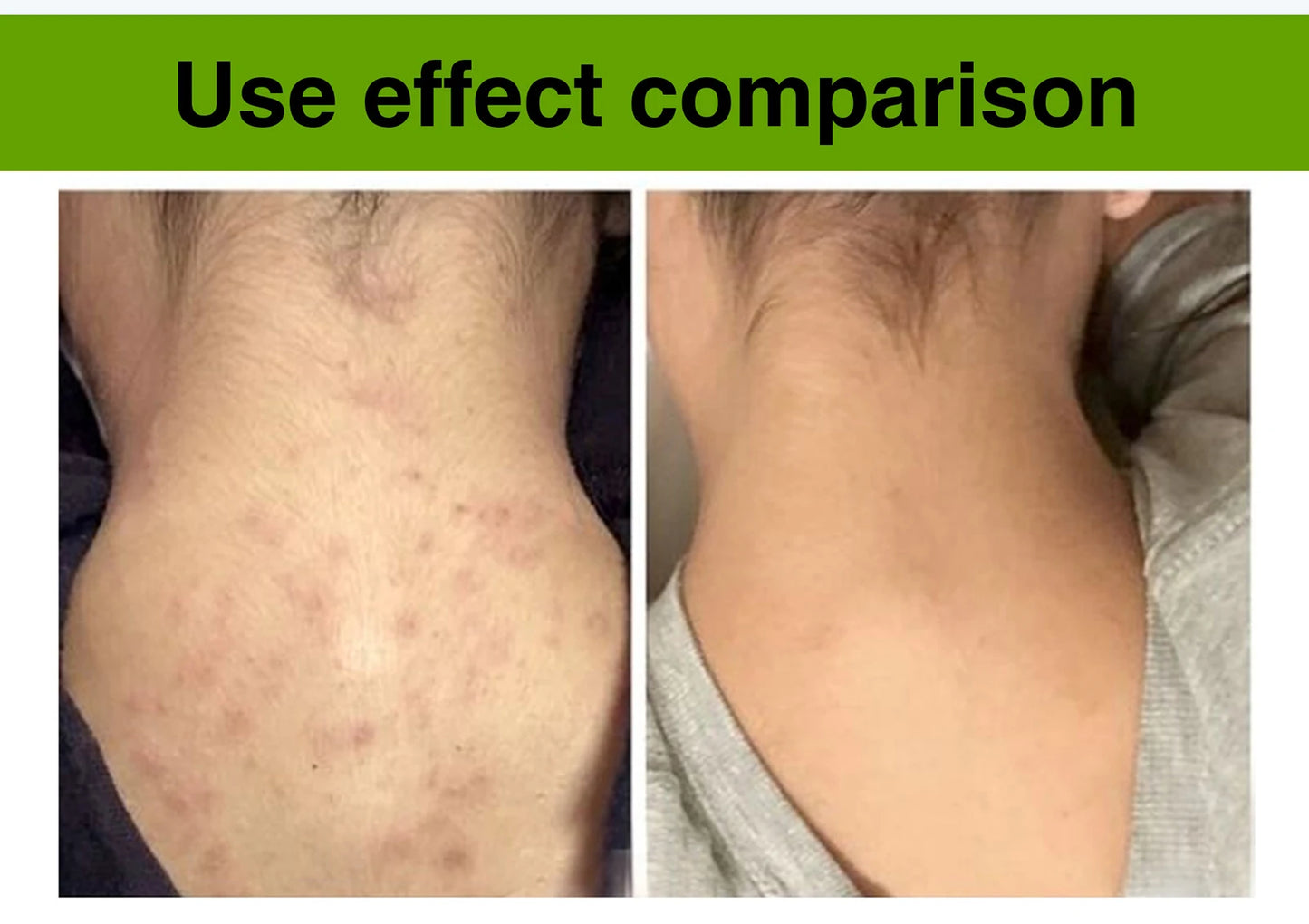 AILKE Aloe Vera Whitening Soap, Remove Acne, Pimples, Skin Radiant, Improve Skin Luster, Vegan Bath Wash for Women Men