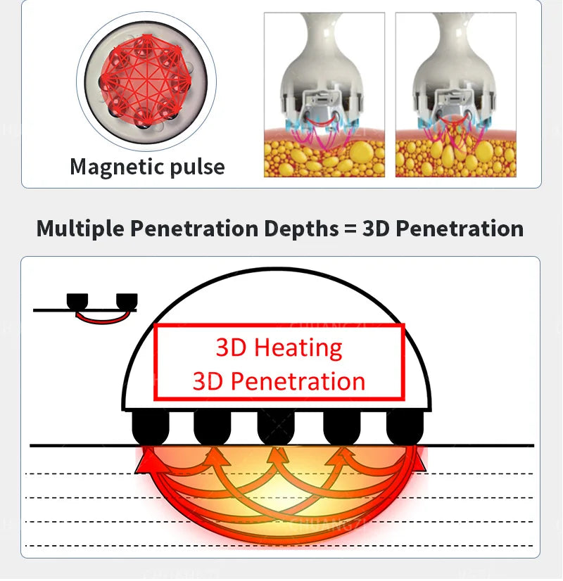 The latest equipment for skin tightening, vacuum slimming and fat removal, traditional skin lifting and spa equipment